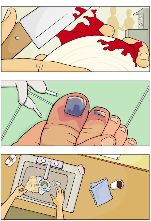 young worker safety illustrations, improper cutting technique, busted toe, burn treatment